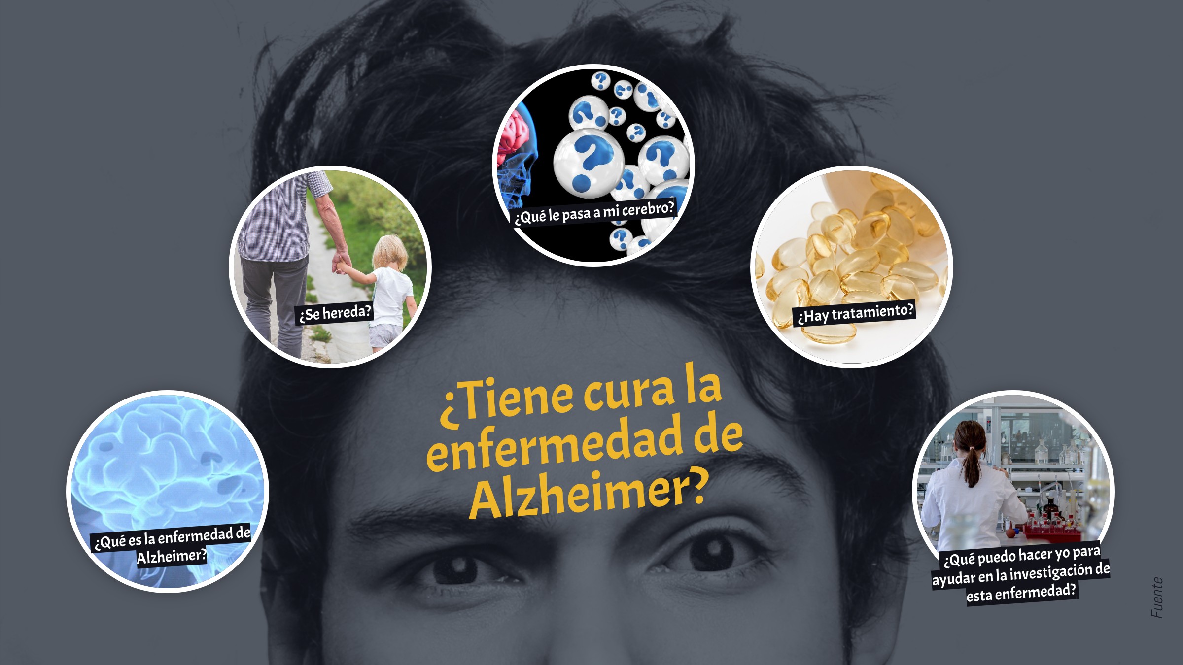 ¿Tiene cura la enfermedad de alzheimer?