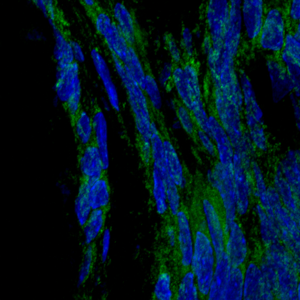 Imagen del tiroides donde se observan mitocondrias en color verde
