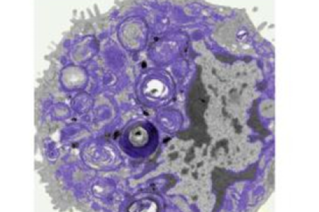 Xerrada "Desenvolupament d'una teràpia cel·lular: del laboratori a l'hospital"