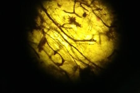 Imagen de una muestra de tejido neuronal vista a través del microscopio